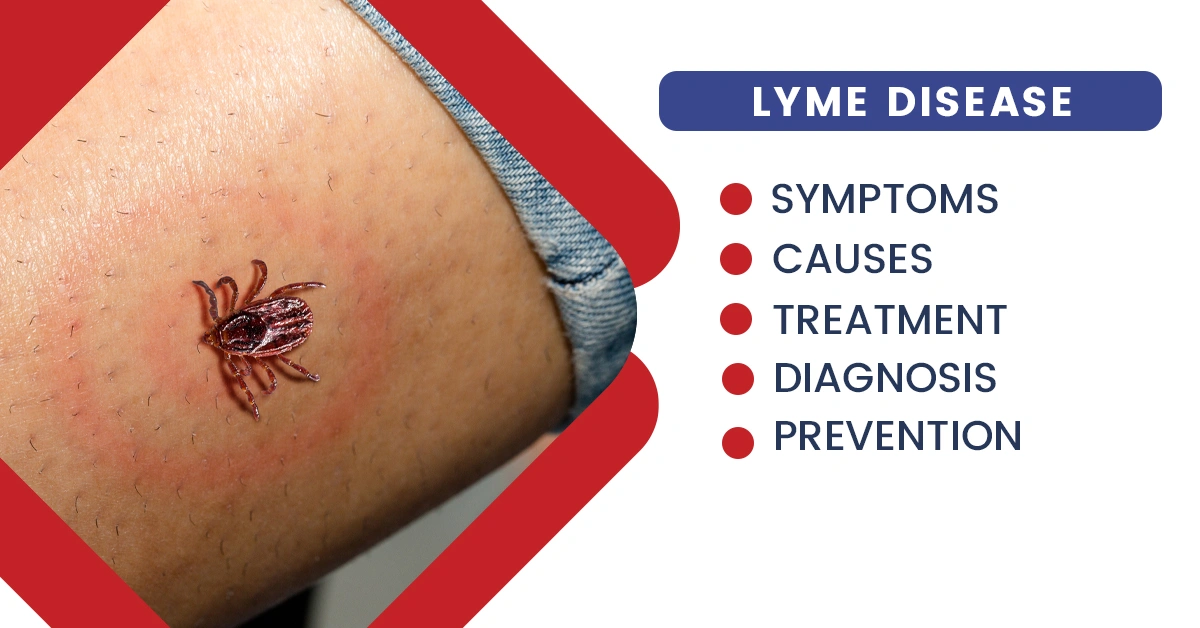 Lyme Disease